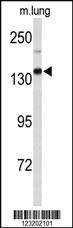 Anti-XDH Rabbit Polyclonal Antibody