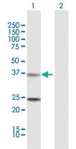 Anti-TNNT2 Rabbit Polyclonal Antibody