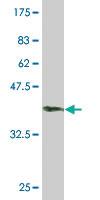 Anti-SETX Mouse Monoclonal Antibody [clone: 2A9]