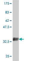 Anti-IP6K1 Mouse Polyclonal Antibody