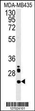 Anti-LHPL3 Rabbit Polyclonal Antibody