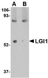 Western blot analysis of LGI1 in mouse brain tissue lysate with LGI1 antibody at 1 &#956;g/mL in (A) the absence and (B) the presence of blocking peptide.