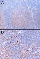 Anti-GATA3 Antibody (A82969) (3 µg/ml) staining of paraffin embedded Human Tonsil Microwaved antigen retrieval with citrate buffer pH 6, HRP-staining A) staining of cells in the germinal centre, B) staining of cells in the interfollicular area