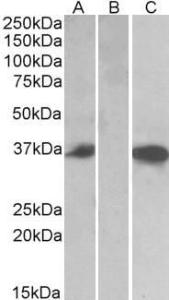 HEK293 lysate (10ug protein in RIPA buffer) over expressing Human CMA1 with DYKDDDDK tag probed with Anti-CMA1 Antibody (A84581) (0