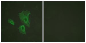 Immunofluorescence analysis of HeLa cells using Anti-BCL-2 (phospho Thr69) Antibody. The right hand panel represents a negative control, where the Antibody was pre-incubated with the immunising peptide