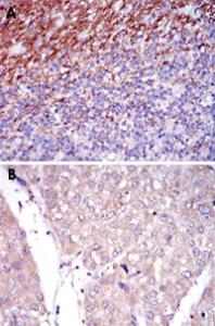 Anti-FUT4 Mouse Monoclonal Antibody [clone: 4E10]