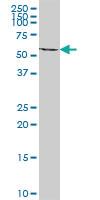 Anti-ACAD9 Mouse Polyclonal Antibody