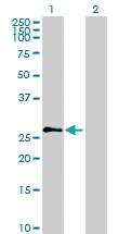 Anti-PRSS2 Mouse Polyclonal Antibody