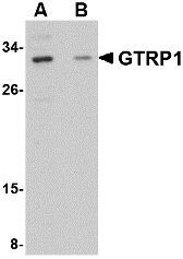 Western blot analysis of GRTP1 in SK-N-SH cell lysate with GRTP1 antibody at 1 &#956;g/mL in the (A) absence and (B) presence of blocking peptide.