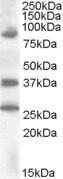 Anti-HOXD10 Antibody (A84582) (0.2 µg/ml) staining of Human Kidney lysate (35 µg protein in RIPA buffer). Primary incubation was 1 hour. Detected by chemiluminescence