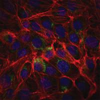 Anti-FUT4 Mouse Monoclonal Antibody [clone: 4E10]