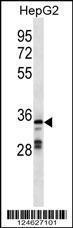 Anti-GPR146 Rabbit Polyclonal Antibody (AP (Alkaline Phosphatase))