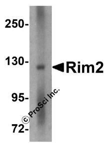 Western blot analysis of Rim2 in rat brain tissue lysate with Rim2 antibody at 1 &#956;g/mL in the (A) absence or (B) presence of blocking peptide.