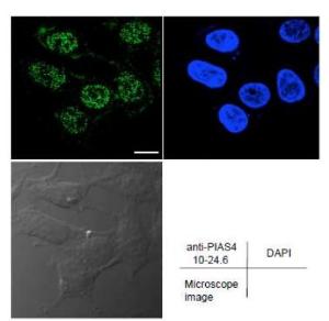Anti-PIAS4 Antibod