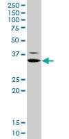 Anti-TNNT2 Rabbit Polyclonal Antibody