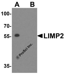 Western blot analysis of LIMP2 in human skeletal muscle tissue lysate with LIMP2 antibody at 1 &#956;g/mL in (A) the absence and (B) presence of blocking peptide.