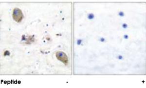 Anti-CD180 Rabbit Polyclonal Antibody