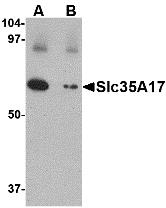 Western blot analysis of Slc22A17 in SK-N-SH lysate with Slc22A17 antibody at 1 &#956;g/mL in (A) the absence and (B) the presence of blocking peptide.