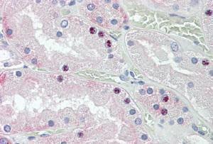 Anti-HOXD10 Antibody (A84582) (3.8 µg/ml) staining of paraffin embedded Human Kidney. Steamed antigen retrieval with citrate buffer pH 6, AP-staining