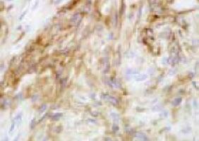 Anti-FOXC2 Mouse Monoclonal Antibody [clone: A3]