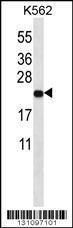 Anti-MT-ND3 Rabbit Polyclonal Antibody (PE (Phycoerythrin))