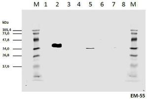 Cell lyzates of HEK293T/17 cells transiently transfected with expression vectors harboring genes for mCD3zeta wild type and six different mCD3zeta mutants