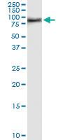 Anti-MDM4 Rabbit Polyclonal Antibody