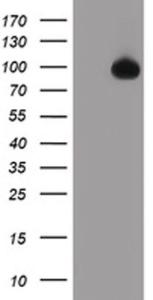 Anti-TFR2 Mouse Monoclonal Antibody [clone: OTI2B4]