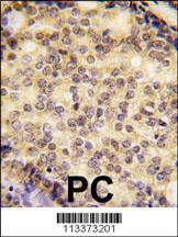 Anti-SOX9 Rabbit Polyclonal Antibody (Biotin)