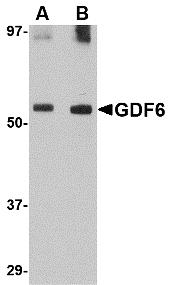 Western blot analysis of Nanos1 in SK-N-SH cell lysate with Nanos1 antibody at 1 &#956;g/mL in (A) the presence and (B) the absence of blocking peptide.