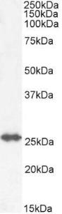 Anti-GSTM4 Antibody (A82971) (0.3 µg/ml) staining of Rat Lung lysate (35 µg protein in RIPA buffer). Detected by chemilu minescence