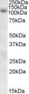 Anti-SNX19 Antibody (A84583) (03 µg/ml) staining of Human Skeletal Muscle lysate (35 µg protein in RIPA buffer) Primary incubation was 1 hour Detected by chemiluminescence