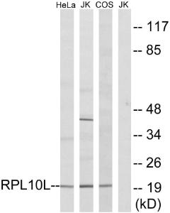 Western blot analysis of lysates from Jurkat, COS7, and HeLa cells using Anti-RPL10L Antibody. The right hand lane represents a negative control, where the antibody is blocked by the immunising peptide