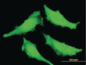 Anti-SENP7 Mouse Monoclonal Antibody [clone: 2D4]