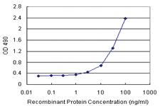 Anti-ADH1C Polyclonal Antibody Pair