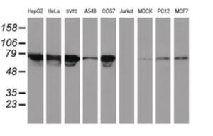 Anti-TFR2 Mouse Monoclonal Antibody [clone: OTI2B4]