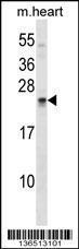 Anti-SOSTDC1 Rabbit Polyclonal Antibody (APC (Allophycocyanin))