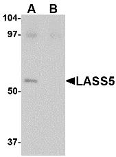 Western blot analysis of LASS5 in SK-N-SH lysate with LASS5 antibody at 1 &#956;g/mL in the (A) absence and (B) presence of blocking peptide.