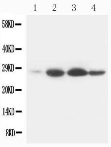 Anti-Bcl-2 Mouse Monoclonal Antibody [clone: BL-2]