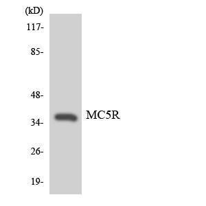 Western blot analysis of the lysates from HeLa cells using Anti-MC5R Antibody