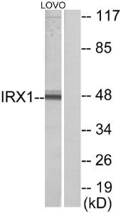 Anti-IRX1 antibody