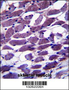 Anti-MYOM1 Rabbit Polyclonal Antibody (Biotin)