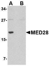 Western blot analysis of MED28 in human brain tissue lysate with MED28 antibody at 1 &#956;g/mL in (A) the absence and (B) the presence of blocking peptide.