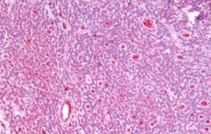 Anti-GSTM4 Antibody (A82971) (5 µg/ml) staining of paraffin embedded Human Tonsil. Steamed antigen retrieval with citrate buffer pH 6, AP-staining