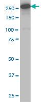 Anti-DNMT1 Mouse Monoclonal Antibody [clone: 2B5]