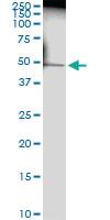 Anti-TNNT2 Rabbit Polyclonal Antibody