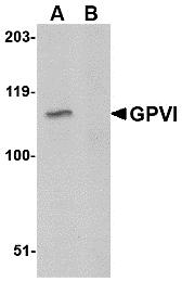 Western blot analysis of GPVI in A20 lysate with GPVI antibody at 1&#956;g/mL in either the absence or (B) the presence of blocking peptide.