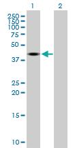 Anti-TRDMT1 Mouse Polyclonal Antibody