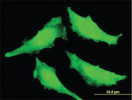 Anti-SENP7 Mouse Monoclonal Antibody [clone: 2D4]