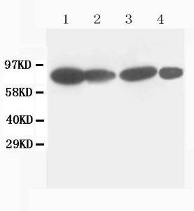 Anti-Catenin gamma (Plakoglobin) Mouse Monoclonal Antibody [clone: CN-3]